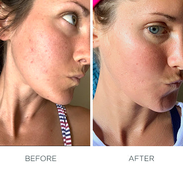 Ozone Face Cream | Quality Controlled | Ozone Apothecary